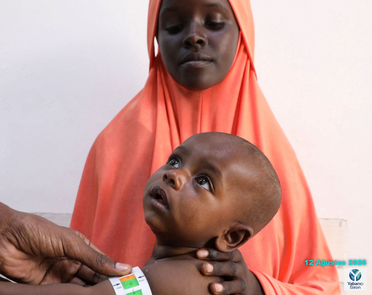 Bir sağlık çalışanı, pazartesi günü Somali'nin Baidoa kentindeki Bay Bölge Hastanesi'nde bir çocuğu yetersiz beslenme taramasından geçiriyor. (Feisal Omar/Reuters)